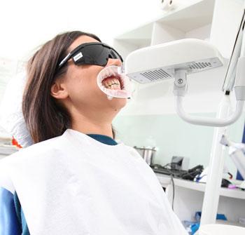 priprema pacijenta za beljenje zuba