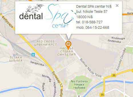 lokacija zubar stomatoloska ordinacija Dental SPA centar
